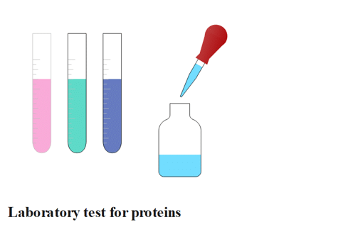 Laboratory test for protein