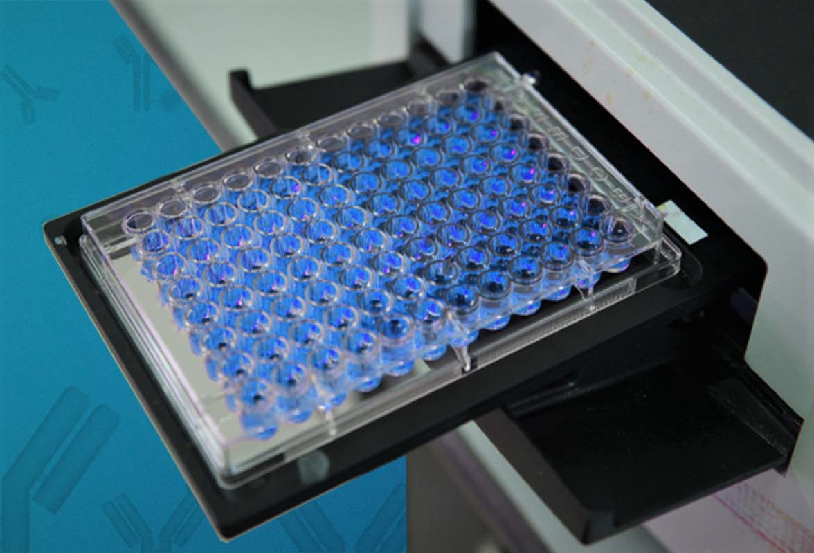 Microplate Reader Easy explanation, and Reliable uses Chemistry Notes