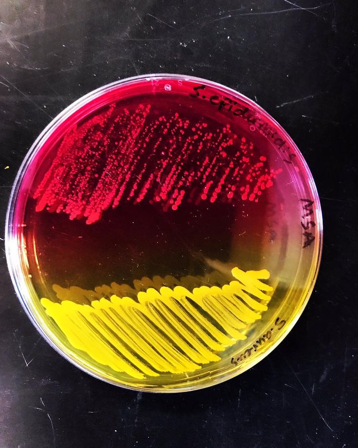 Mannitol Salt Agar