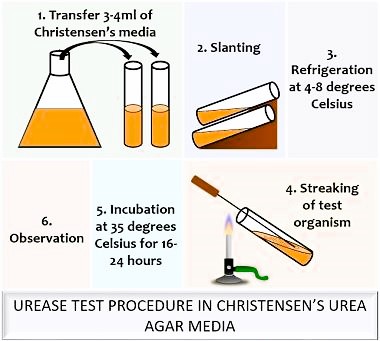protocol of urease test