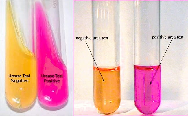 Urease Test