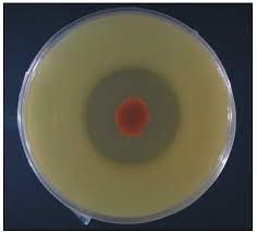 skim milk agar