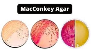 MacConkey Agar