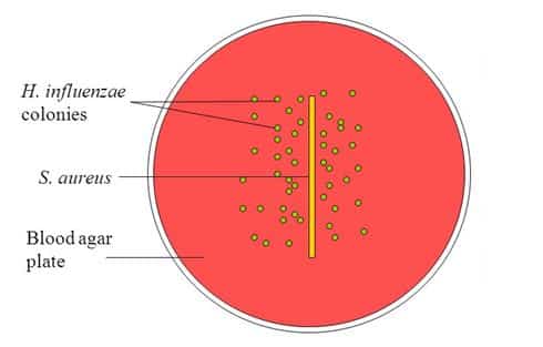 Satellitism Test